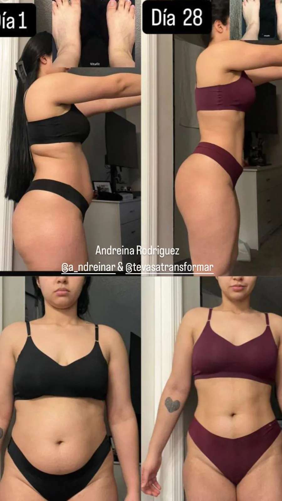 Resultado antes y después de Andreina Rodriguez con el Método TVT