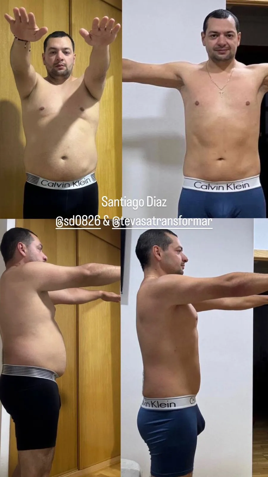 Resultado antes y después de Santiago Diaz con el Método TVT